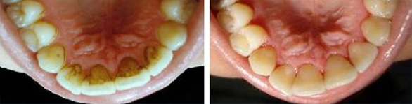 fórum dental fogászat ügyelet debrecen fehérebbfogakért