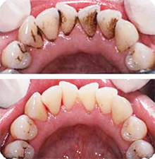 fórum dental fogászat ügyelet debrecen fog polírozás