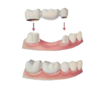 fórum dental fogászat ügyelet debrecen fogpótlás modell