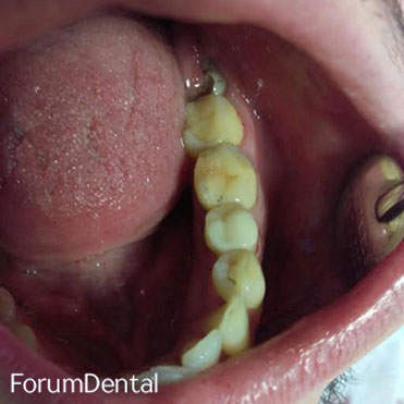 fórum dental fogászat ügyelet debrecen onlay beragasztás