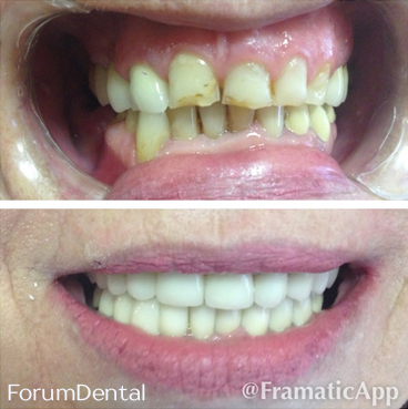 fórum dental fogászat ügyelet debrecen teljes protetikai rehabilitálás