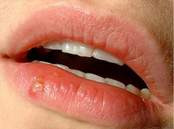 fórum dental fogászat ügyelet debrecen herpesz