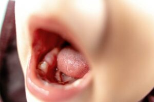 fórum dental fogászat ügyelet debrecen barázdazárás