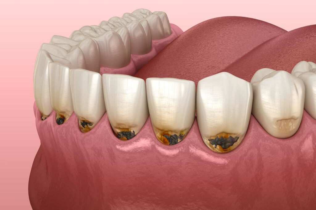 fórum dental fogászat ügyelet debrecen fogágy betegségei