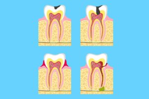 fórum dental fogászat ügyelet debrecen fogágy betegségei