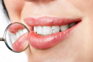fórum dental fogászat ügyelet debrecen fogékszer