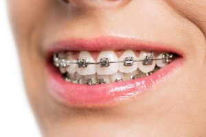 fórum dental fogászat ügyelet debrecen fogszabályzás
