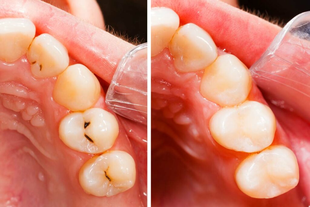 fórum dental fogászat ügyelet debrecen fogtömés