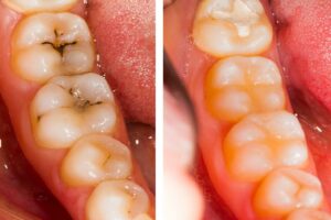 fórum dental fogászat ügyelet debrecen minden amit fogtömésről tudni érdemes